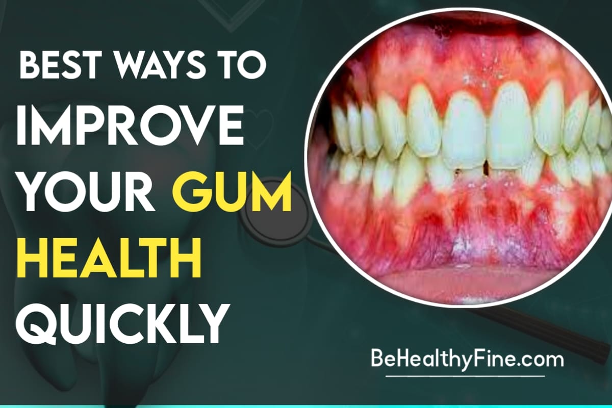 Best Ways to Improve your Gum Health Quickly