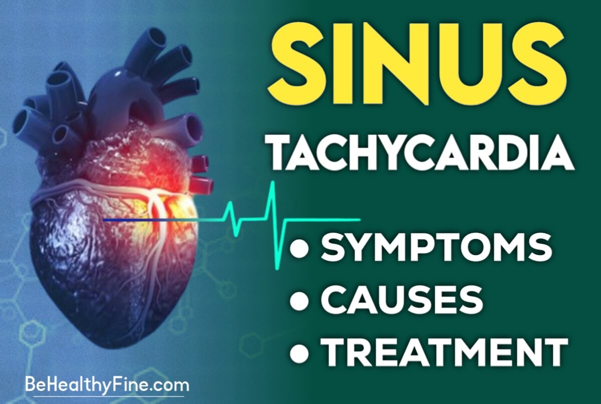 Sinus Tachycardia | Symptoms, Causes, and Treatment. Visit site Now