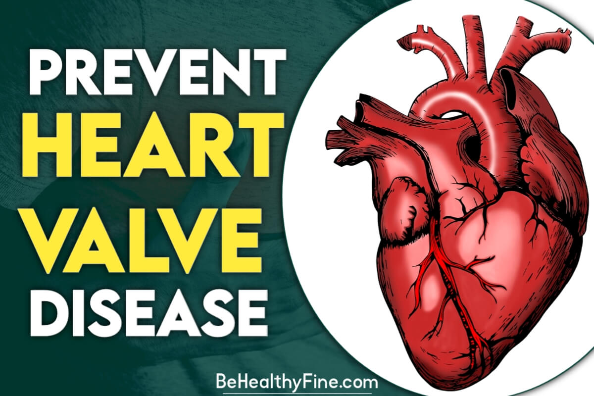 How to Prevent Heart Valve Disease